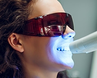 Teeth Whitening Image